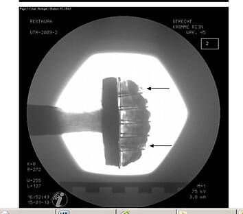 Röntgenfoto met de plaats van de stiftjes waarmee de versierde eindknop op de eindplaat is bevestigd. Restauratieatelier Restaura